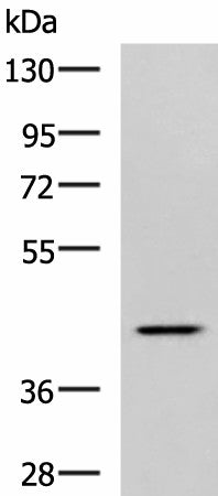 Western blot analysis of Hela cell lysate using SYT2 Polyclonal Antibody at dilution of 1:800