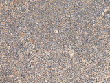 Immunohistochemistry of paraffin-embedded Human tonsil tissue using KCNE3 Polyclonal Antibody at dilution of 1:55(×200)