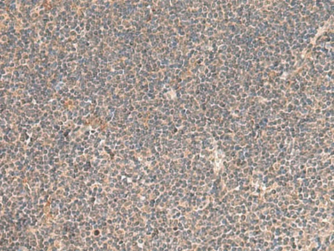 Immunohistochemistry of paraffin-embedded Human tonsil tissue using KCNE3 Polyclonal Antibody at dilution of 1:55(×200)