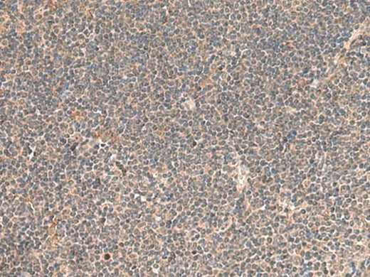 Immunohistochemistry of paraffin-embedded Human tonsil tissue using KCNE3 Polyclonal Antibody at dilution of 1:55(×200)