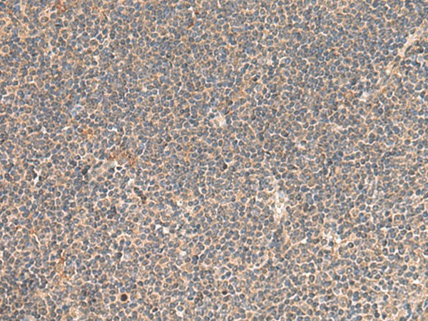 Immunohistochemistry of paraffin-embedded Human tonsil tissue using KCNE3 Polyclonal Antibody at dilution of 1:55(×200)