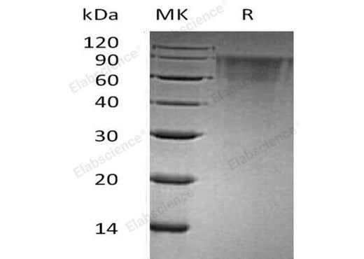 Recombinant Human THSD1/TMTSP Protein (His Tag) - ABMIUM