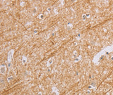 Anti-Human BGLAP Antibody - ABMIUM