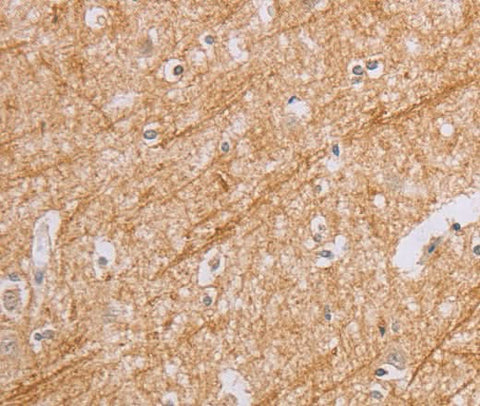 Anti-Human BGLAP Antibody - ABMIUM