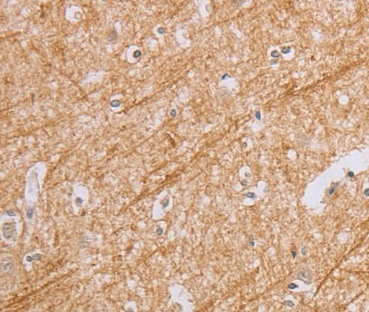 Anti-Human BGLAP Antibody - ABMIUM