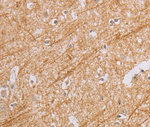 Anti-Human BGLAP Antibody - ABMIUM