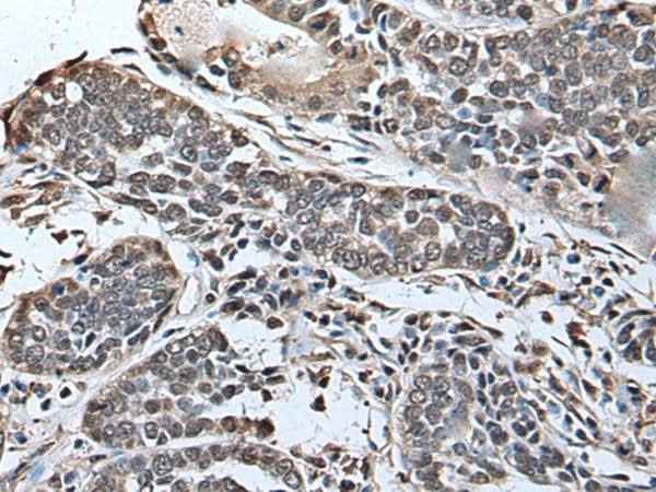 Anti-Human/Mouse SLITRK5 Antibody