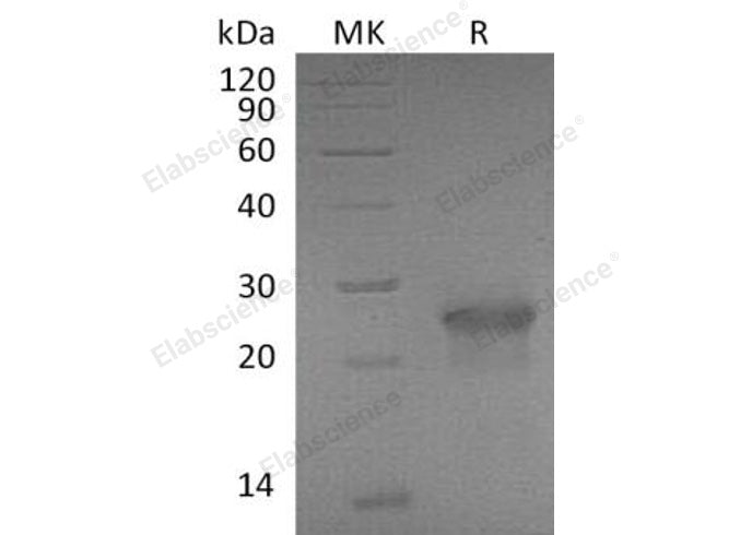 Recombinant Mouse XEDAR/EDA2R Protein (Fc Tag) - ABMIUM