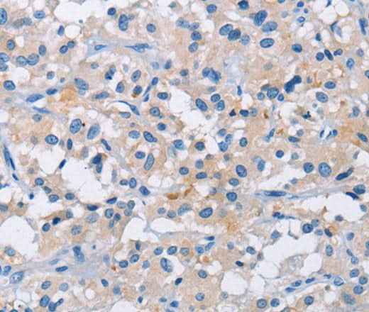 Anti-Human/Mouse/Rat ATP6AP2 Antibody