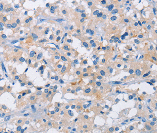 Anti-Human/Mouse/Rat ATP6AP2 Antibody - ABMIUM