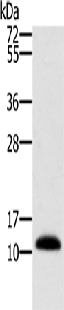 Anti-Human MSMB Antibody - ABMIUM