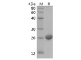 SDS-PAGE analysis of Human RAC1 proteins, 2 μg/lane of Recombinant Human RAC1 proteins was resolved with SDS-PAGE under reducing conditions, showing bands at 22 kDa.