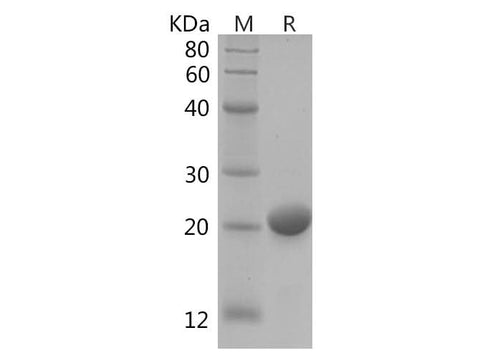 SDS-PAGE analysis of Human RAC1 proteins, 2 μg/lane of Recombinant Human RAC1 proteins was resolved with SDS-PAGE under reducing conditions, showing bands at 22 kDa.