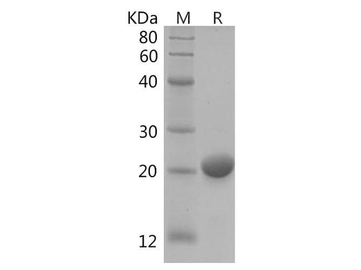 SDS-PAGE analysis of Human RAC1 proteins, 2 μg/lane of Recombinant Human RAC1 proteins was resolved with SDS-PAGE under reducing conditions, showing bands at 22 kDa.