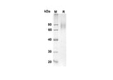 SDS-PAGE analysis of Human IL7R proteins, 2 μg/lane of Recombinant Human IL7R proteins was resolved with an SDS-PAGE under reducing conditions, showing bands at 50.4 kDa.