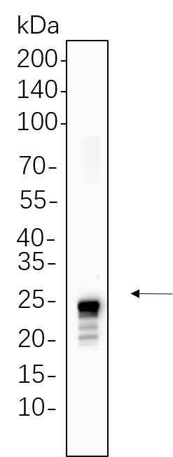 Anti-Human/Mouse/Rat TAGLN Antibody [B1137]