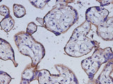Anti-Human CD105 Antibody - ABMIUM