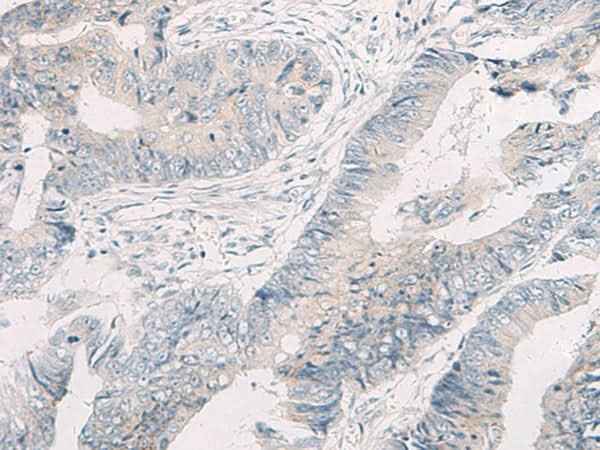 Anti-Human/Mouse/Rat WNK4 Antibody