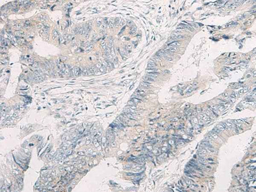 Anti-Human/Mouse/Rat WNK4 Antibody