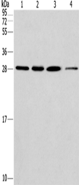 Anti-Human/Mouse/Rat ERP29 Antibody - ABMIUM
