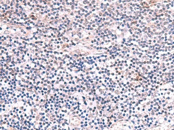Immunohistochemistry of paraffin-embedded Human tonsil tissue using INPP5K Polyclonal Antibody at dilution of 1:85(×200)