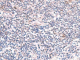 Immunohistochemistry of paraffin-embedded Human tonsil tissue using INPP5K Polyclonal Antibody at dilution of 1:85(×200)
