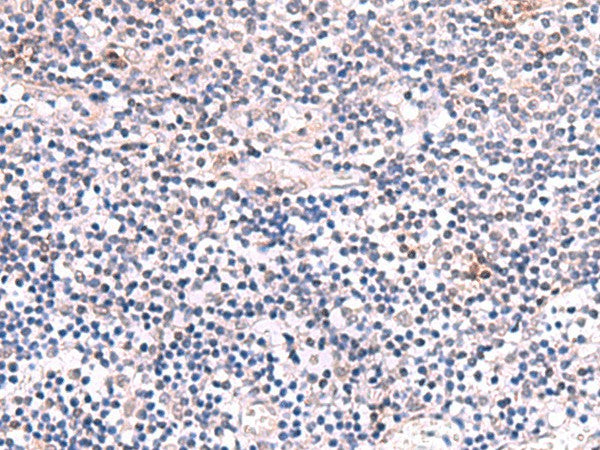 Immunohistochemistry of paraffin-embedded Human tonsil tissue using INPP5K Polyclonal Antibody at dilution of 1:85(×200)