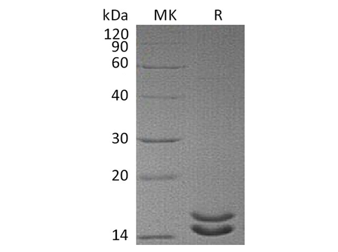 Recombinant Human Interleukin-2/IL-2 Protein (Mutant) - ABMIUM