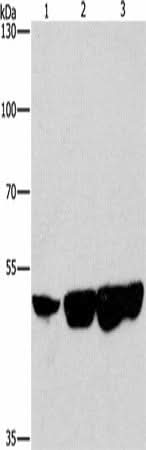 Anti-Human/Mouse/Rat CTBP2 Antibody - ABMIUM