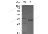 Recombinant Mouse NBL1/DAND1 Protein (His Tag) - ABMIUM