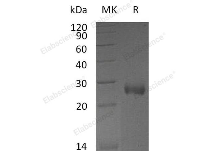 Recombinant Mouse NBL1/DAND1 Protein (His Tag) - ABMIUM