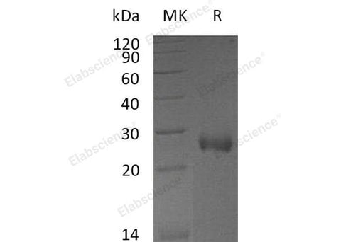Recombinant Mouse NBL1/DAND1 Protein (His Tag) - ABMIUM