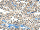 Anti-Human REST Antibody - ABMIUM