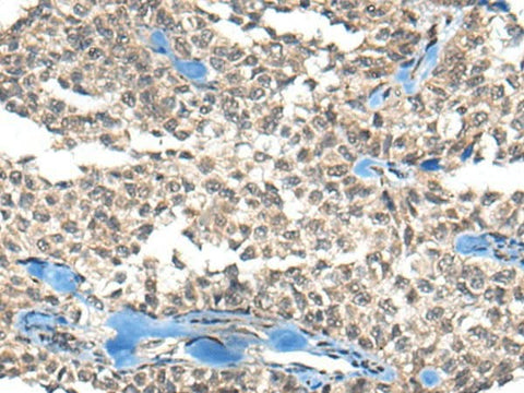 Anti-Human REST Antibody - ABMIUM