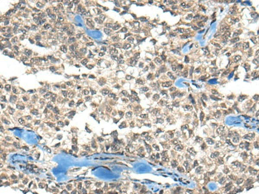 Anti-Human REST Antibody - ABMIUM