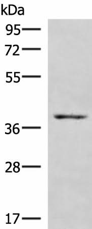 Western blot analysis of NIH/3T3 cell lysate using HOXD9 Polyclonal Antibody at dilution of 1:1000