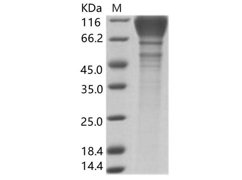 Recombinant HIV-1 (group M, subtype B, strain SHIV-89.6P) gp120 Protein (His Tag) - ABMIUM