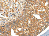 Anti-Human/Mouse/Rat UBIAD1 Antibody - ABMIUM