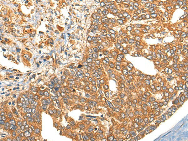 Anti-Human/Mouse/Rat UBIAD1 Antibody - ABMIUM