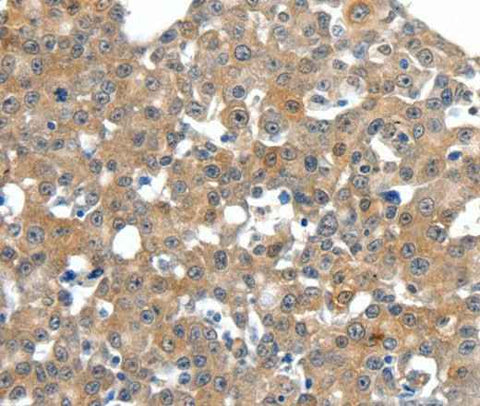 Anti-Human/Mouse/Rat SCN11A Antibody
