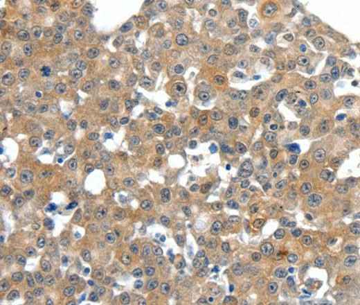 Anti-Human/Mouse/Rat SCN11A Antibody