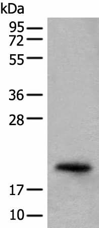 Western blot analysis of Mouse eye tissue lysate using CRYGS Polyclonal Antibody at dilution of 1:800