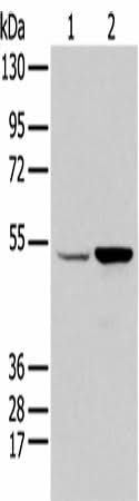 Western blot analysis of HEPG2 and 231 cell using EGR2 Polyclonal Antibody at dilution of 1:350