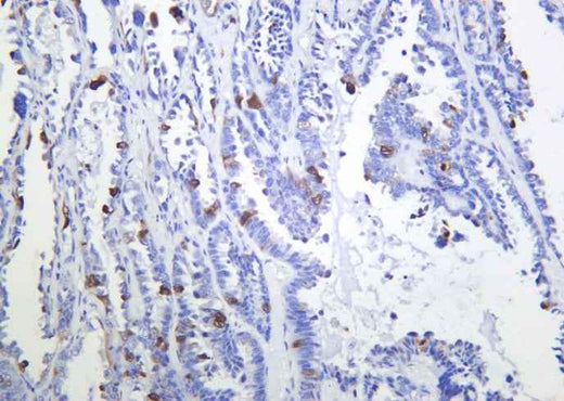 Anti-Human/Mouse/Rat CDK1, 2 Antibody [B904] - ABMIUM