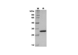 SDS-PAGE analysis of Rat LCN2 proteins, 2 μg/lane of Recombinant Rat LCN2 proteins, was resolved with SDS-PAGE under reducing conditions, showing bands at 25 kDa.