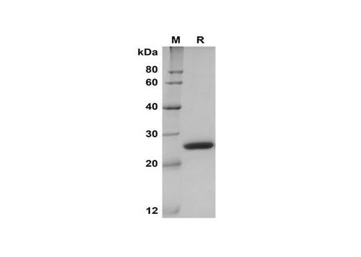 SDS-PAGE analysis of Rat LCN2 proteins, 2 μg/lane of Recombinant Rat LCN2 proteins, was resolved with SDS-PAGE under reducing conditions, showing bands at 25 kDa.
