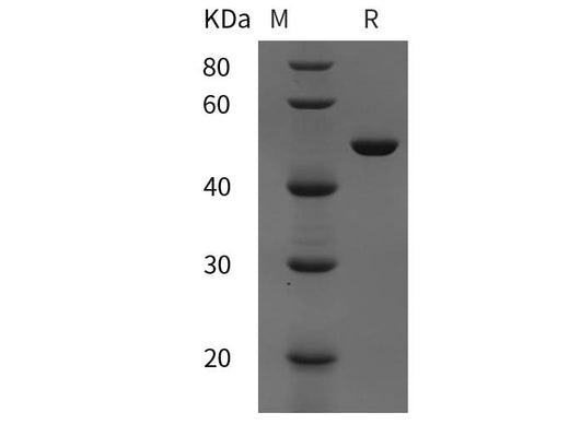 SDS-PAGE analysis of Rat SerpinA1/A1AT proteins, 2 μg/lane of Recombinant Rat SerpinA1/A1AT proteins was resolved with SDS-PAGE under reducing conditions, showing bands at 50 kDa.