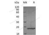Recombinant Mouse COL18A1/Endostatin Protein (His Tag) - ABMIUM