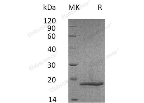 Recombinant Mouse COL18A1/Endostatin Protein (His Tag) - ABMIUM