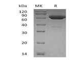 Recombinant Human tPA/PLAT Protein (His Tag) - ABMIUM
